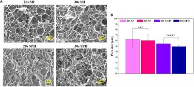 Progress in Silk Fibroin Based Composite Scaffold/Hydrogel: Silk Fibroin/PEG Hydrogel for the RPE Regeneration a Promising Biomaterial for Clinical Application